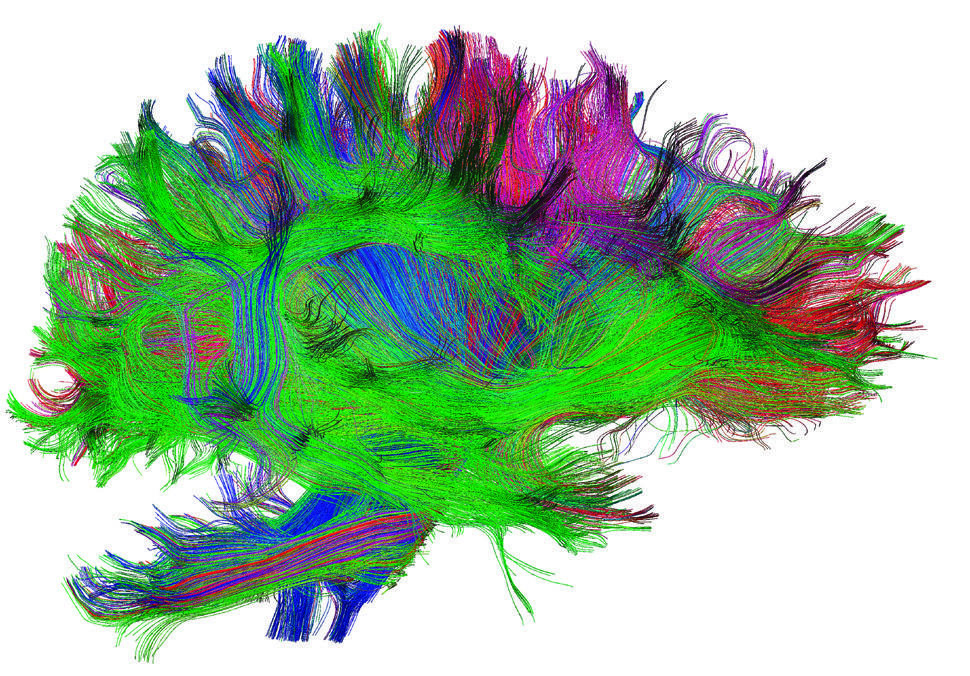 Colored 3D diffusion spectral imaging scan